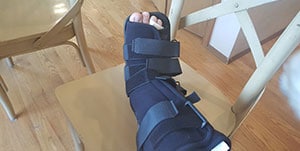 Broken Leg Cast Walking Boot