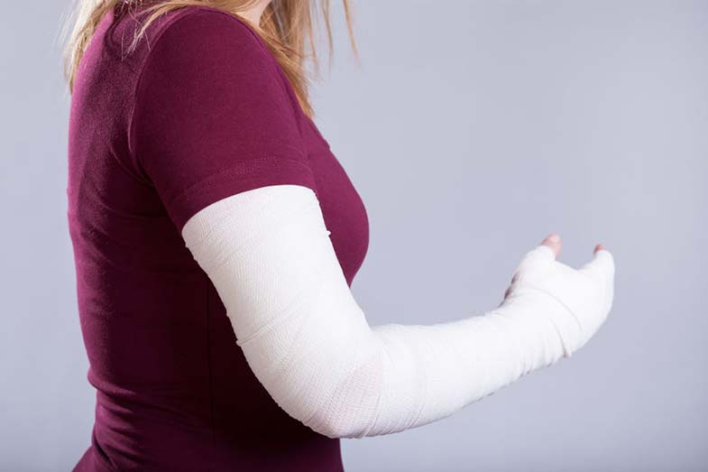 Girl Wearing Cast for Broken Arm